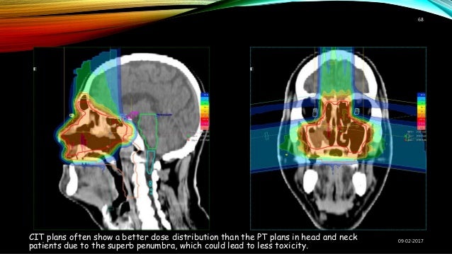 Imaging in Treatment Planning for Sinonasal Diseases (Medical Radiology)